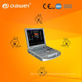 DW-C60PLUS máquina de ultra-som baseado em pc e doppler ecógrafo a cores